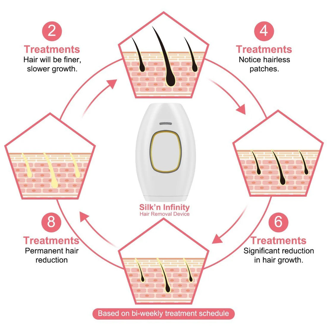 Freezing Point Laser Hair Removal Apparatus Handheld Facial Whole Body Beauty Apparatus Female ipl Photon Laser Hair Removal Apparatus