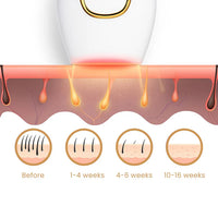 Freezing Point Laser Hair Removal Apparatus Handheld Facial Whole Body Beauty Apparatus Female ipl Photon Laser Hair Removal Apparatus